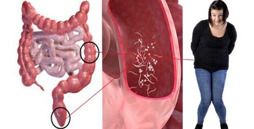 Parasites dans le corps