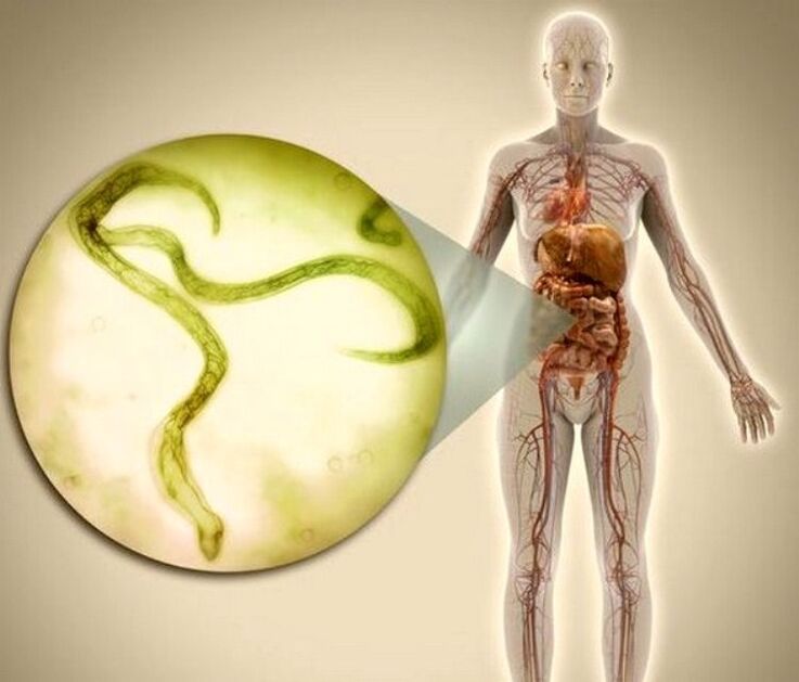 Parasites dans le corps