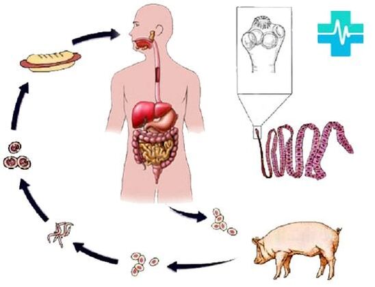 Infection